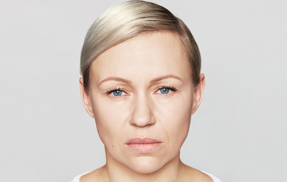 Glowing face of a woman after frown line treatment