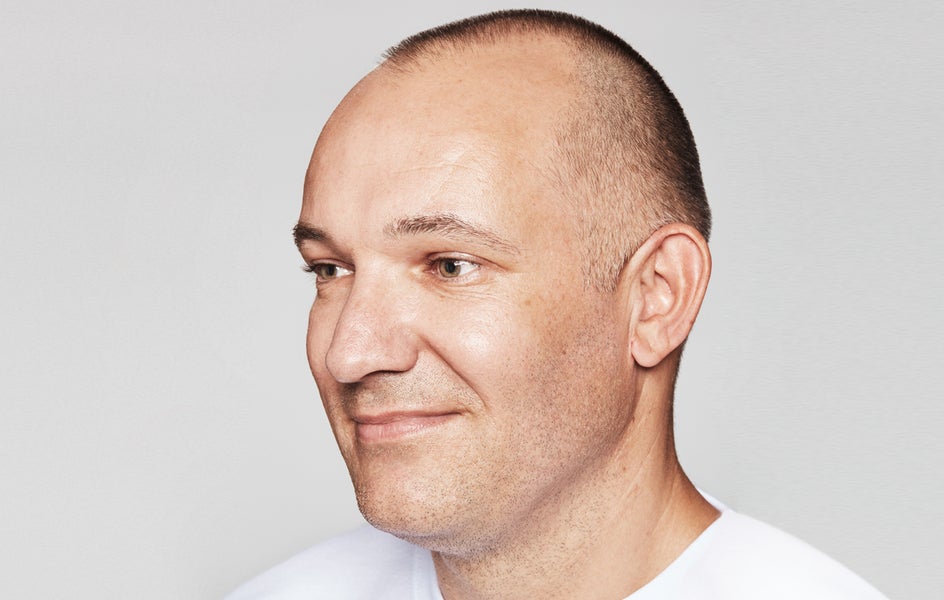 A man looking happy after undergoing treatment for crow's feet