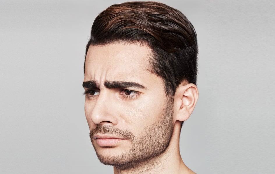 The man's frown lines before anti-wrinkle treatment