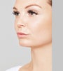A woman's cheeks and lips before dermal fillers