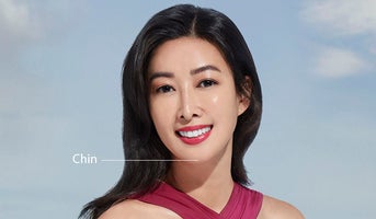 A-stunning-woman-with-a-beautiful-chin
