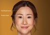 An-aesthetic-skin-treatment-blurb-featuring-a-woman